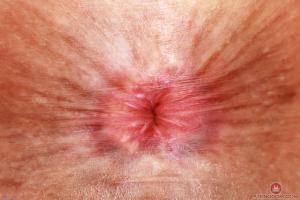 Original 3000 px/ 2000 px