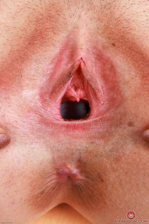 Original 2000 px/ 3000 px