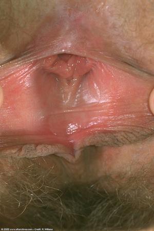 Original 682 px/ 1024 px