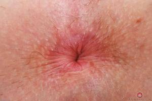 Original 3000 px/ 2000 px