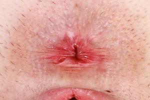 Original 4096 px/ 2731 px