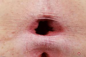 Original 3000 px/ 2000 px