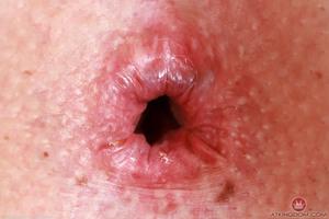 Original 5000 px/ 3333 px