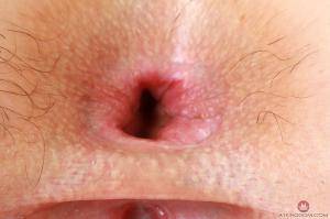 Original 3000 px/ 1999 px