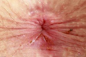 Original 3000 px/ 1999 px