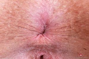 Original 5000 px/ 3333 px