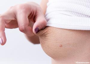 Original 3000 px/ 2143 px