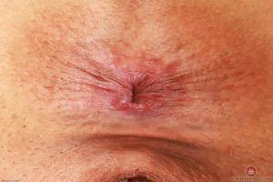 Original 3000 px/ 2000 px