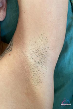 Original 2000 px/ 3000 px