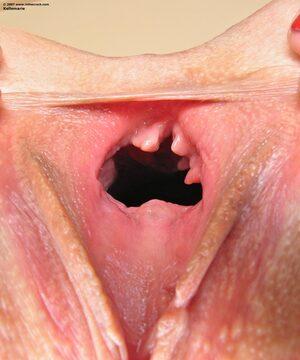 Original 1500 px/ 1800 px