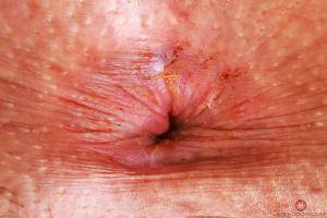 Original 3000 px/ 2000 px