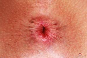 Original 3000 px/ 2000 px