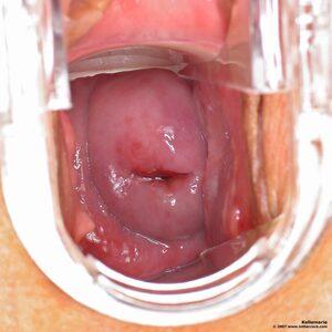 Original 1400 px/ 1400 px