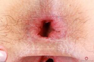 Original 3000 px/ 1999 px