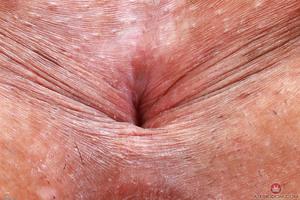 Original 3000 px/ 1999 px