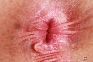 Original 3000 px/ 2000 px