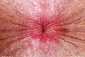 Original 5000 px/ 3333 px