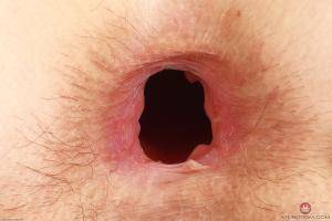 Original 3000 px/ 2000 px