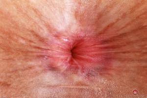 Original 3000 px/ 2000 px