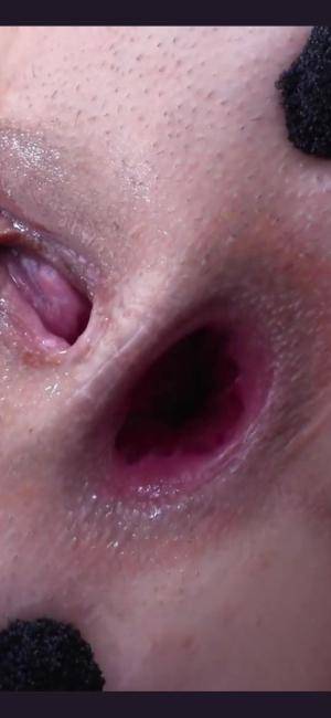 Original 945 px/ 2048 px