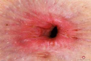 Original 3000 px/ 2000 px