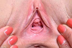 Original 3000 px/ 2000 px