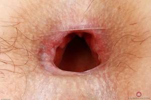 Original 3000 px/ 2000 px