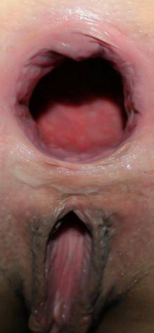 Original 945 px/ 2048 px