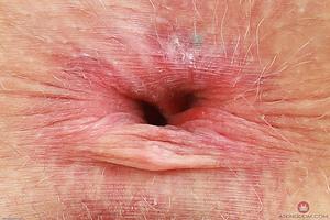 Original 3000 px/ 1998 px