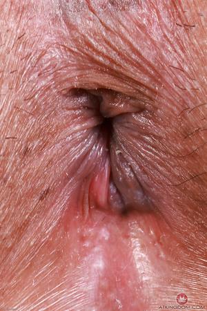 Original 2001 px/ 3000 px