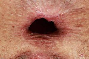 Original 3000 px/ 2000 px