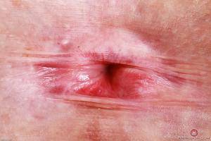 Original 3000 px/ 2000 px