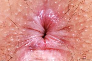 Original 3000 px/ 2000 px