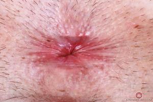 Original 5000 px/ 3333 px