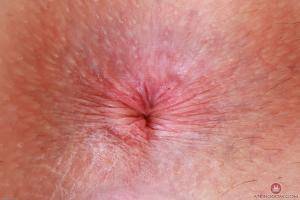 Original 3000 px/ 2000 px