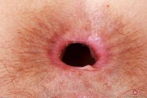 Original 3000 px/ 2000 px