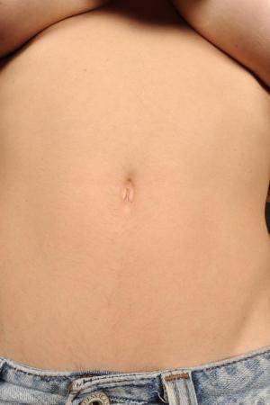 Original 682 px/ 1024 px