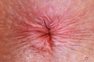 Original 3000 px/ 2000 px