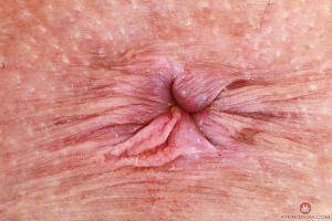 Original 3000 px/ 2000 px