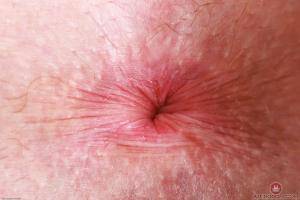 Original 3000 px/ 2000 px