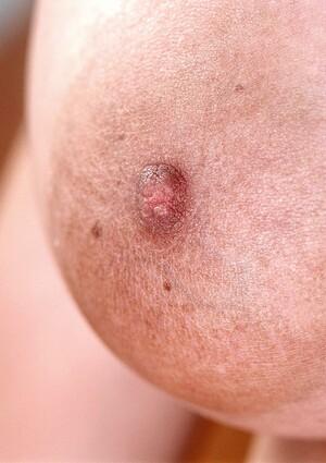 Original 800 px/ 1132 px