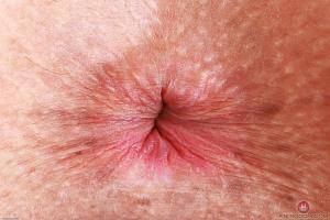 Original 3000 px/ 2000 px