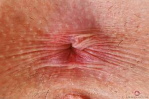 Original 3000 px/ 2000 px