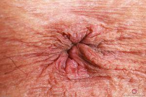 Original 3000 px/ 2000 px