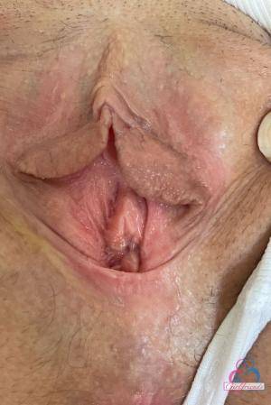 Original 854 px/ 1280 px