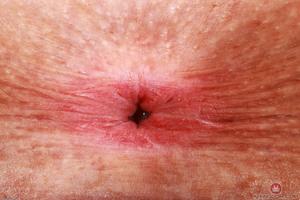 Original 3000 px/ 2000 px