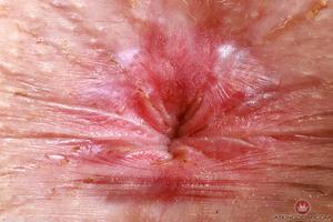 Original 5000 px/ 3333 px