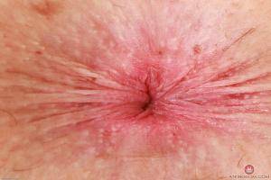 Original 3000 px/ 2000 px