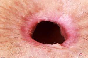 Original 3000 px/ 2000 px