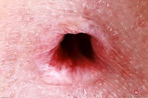 Original 3000 px/ 2000 px